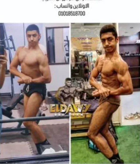 قبل وبعد: تفاصيل أكتر ووقفة أقوى